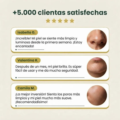 Pala Ultrasónica Facial 3 en 1 – Limpieza de Poros y Exfoliación para una Piel Suave y Fresca
