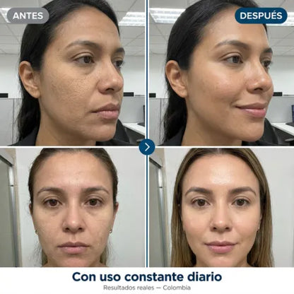 Neocell Serum Facial (Ácido Hialurónico + Niacinamida) - Alivio para Piel Seca y Acartonada - Absorción Rápida Sin Residuos Grasos