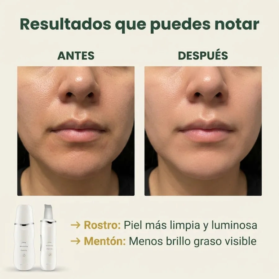 Pala Ultrasónica Facial 3 en 1 – Limpieza de Poros y Exfoliación para una Piel Suave y Fresca