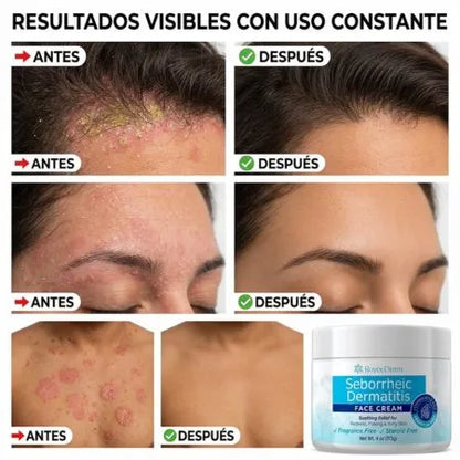 ELIMINA LA DERMATITIS DE RAÍZ