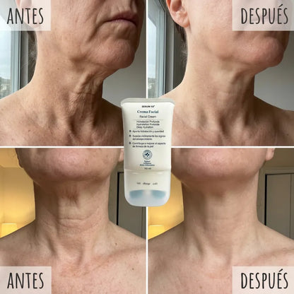 Crema Reafirmante con Rodillo: Cuello Más Firme y Sin Arrugas en 3 Semanas