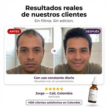 The Ordinary Serum Capilar Multi-Péptidos