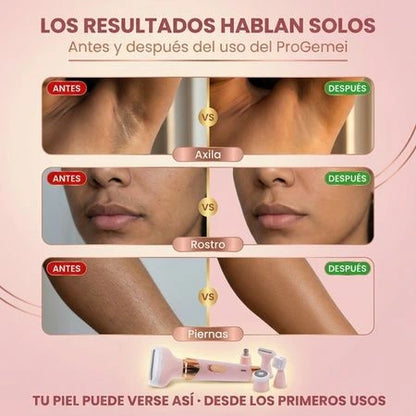 Maquina Depiladora Femenina 4 En 1