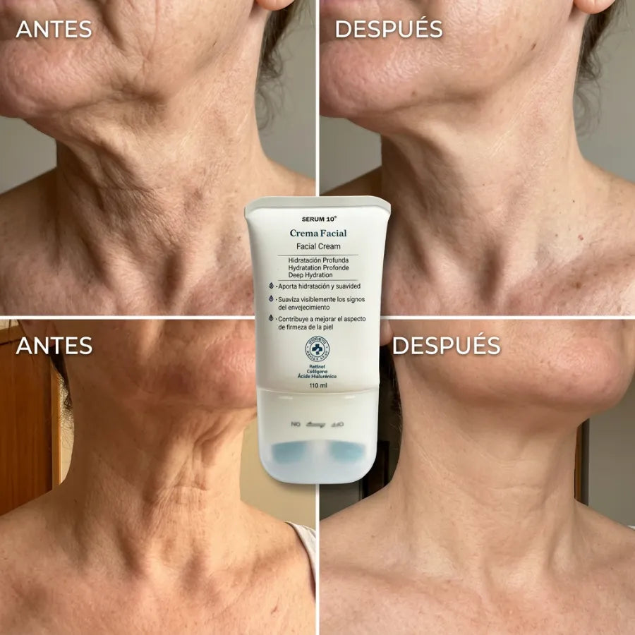 Crema Reafirmante con Rodillo: Cuello Más Firme y Sin Arrugas en 3 Semanas