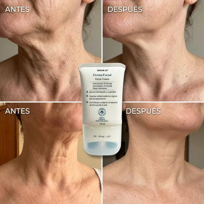 Crema Reafirmante con Rodillo: Cuello Más Firme y Sin Arrugas en 3 Semanas