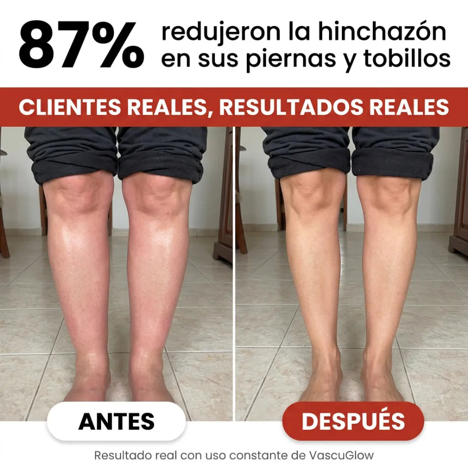 VascuGlow™ | Elimina la Presión Alta y Recupera tu Circulación en 10 Días