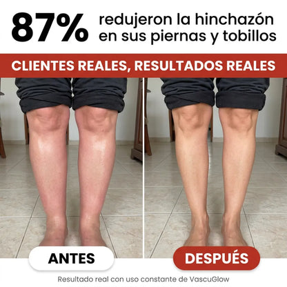 VascuGlow™ | Elimina la Presión Alta y Recupera tu Circulación en 10 Días