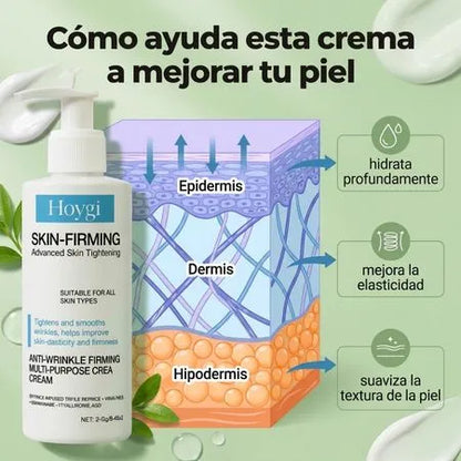 Hoygi Skin – Elimina la Celulitis y Reafirma Tu Piel
