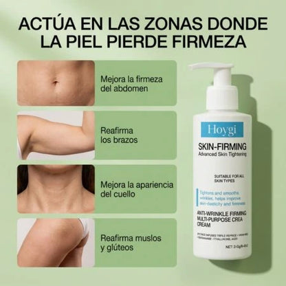 Hoygi Skin – Elimina la Celulitis y Reafirma Tu Piel