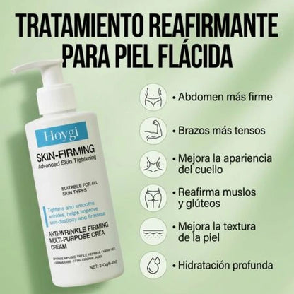 Hoygi Skin – Elimina la Celulitis y Reafirma Tu Piel