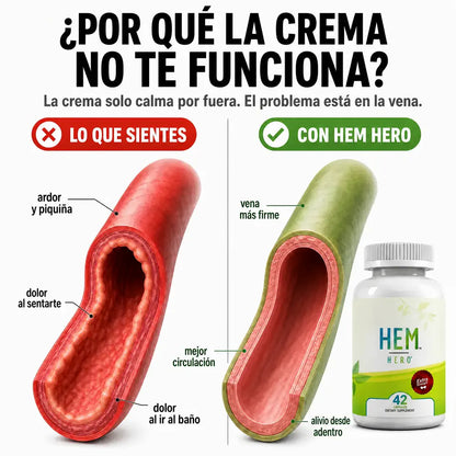 Por qué la crema no te funciona